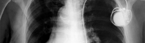 radiografia-rayosx-torax